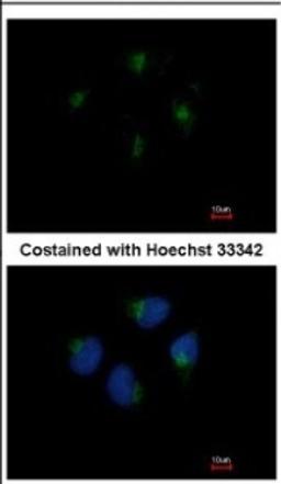 Immunocytochemistry/Immunofluorescence: KIF20A Antibody [NBP2-17052] - Immunofluorescence analysis of methanol-fixed HeLa, using antibody at 1:200 dilution.