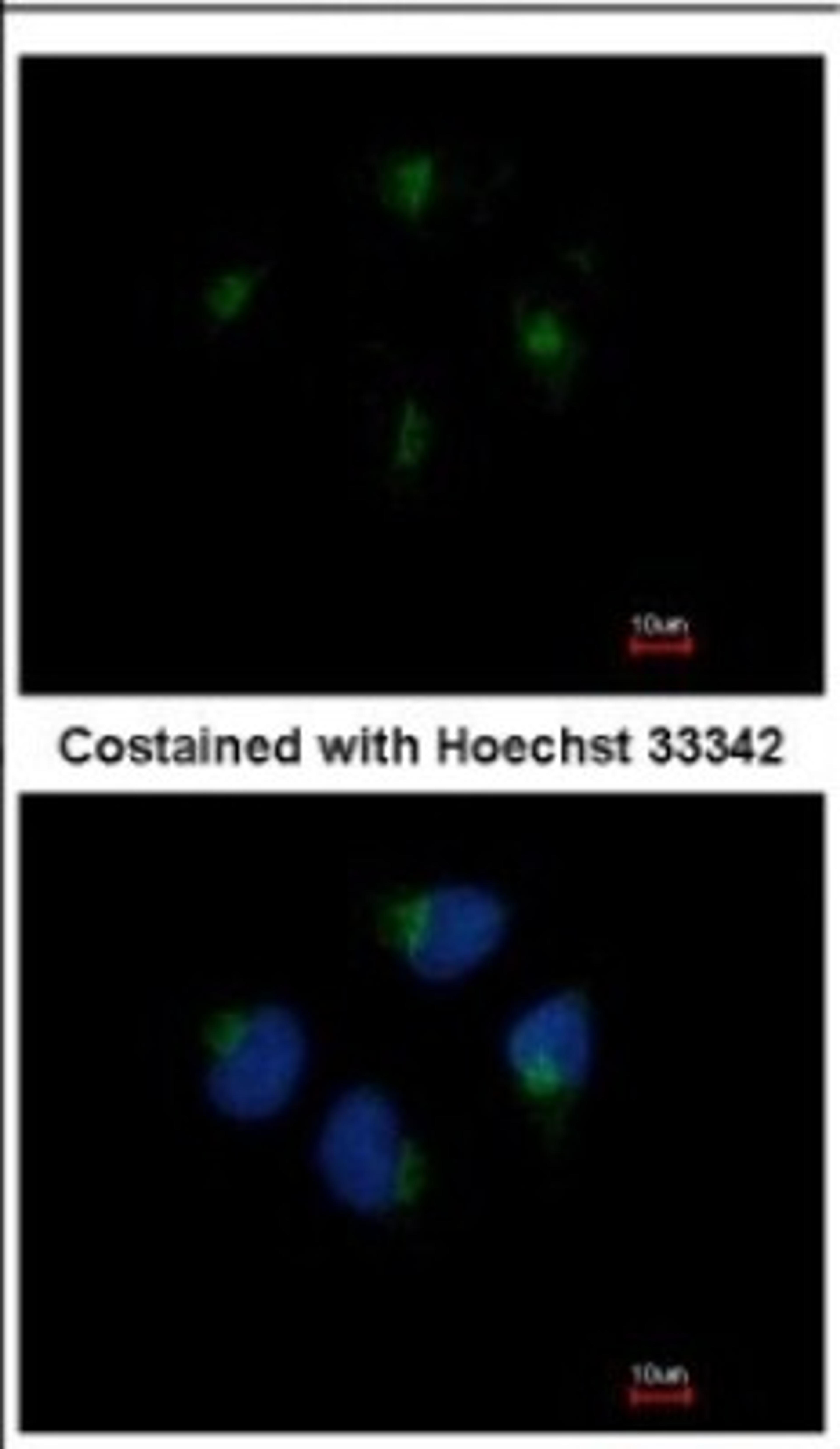 Immunocytochemistry/Immunofluorescence: KIF20A Antibody [NBP2-17052] - Immunofluorescence analysis of methanol-fixed HeLa, using antibody at 1:200 dilution.