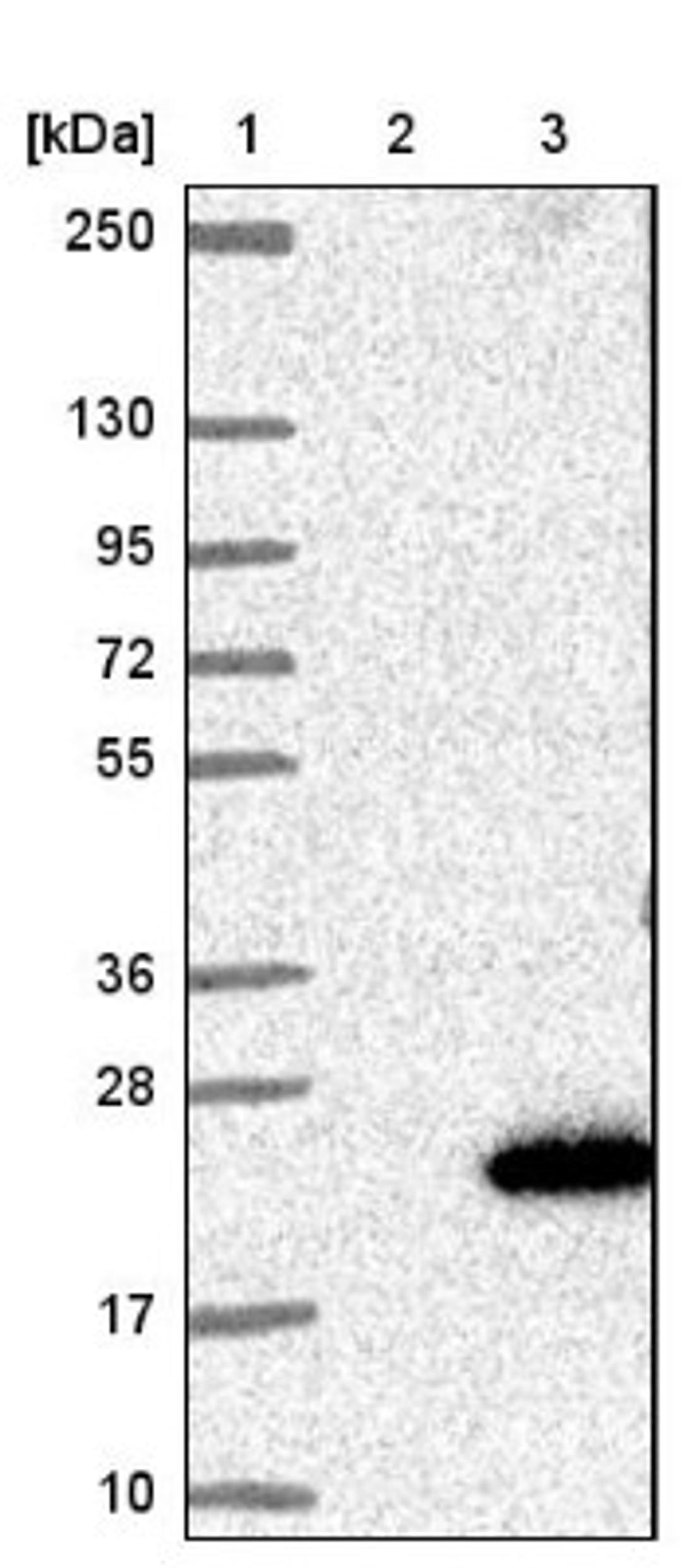 Western Blot: SCP2D1 Antibody [NBP1-84248] - Lane 1: Marker [kDa] 250, 130, 95, 72, 55, 36, 28, 17, 10<br/>Lane 2: Negative control (vector only transfected HEK293T lysate)<br/>Lane 3: Over-expression lysate (Co-expressed with a C-terminal myc-DDK tag (~3.1 kDa) in mammalian HEK293T cells, LY405885)