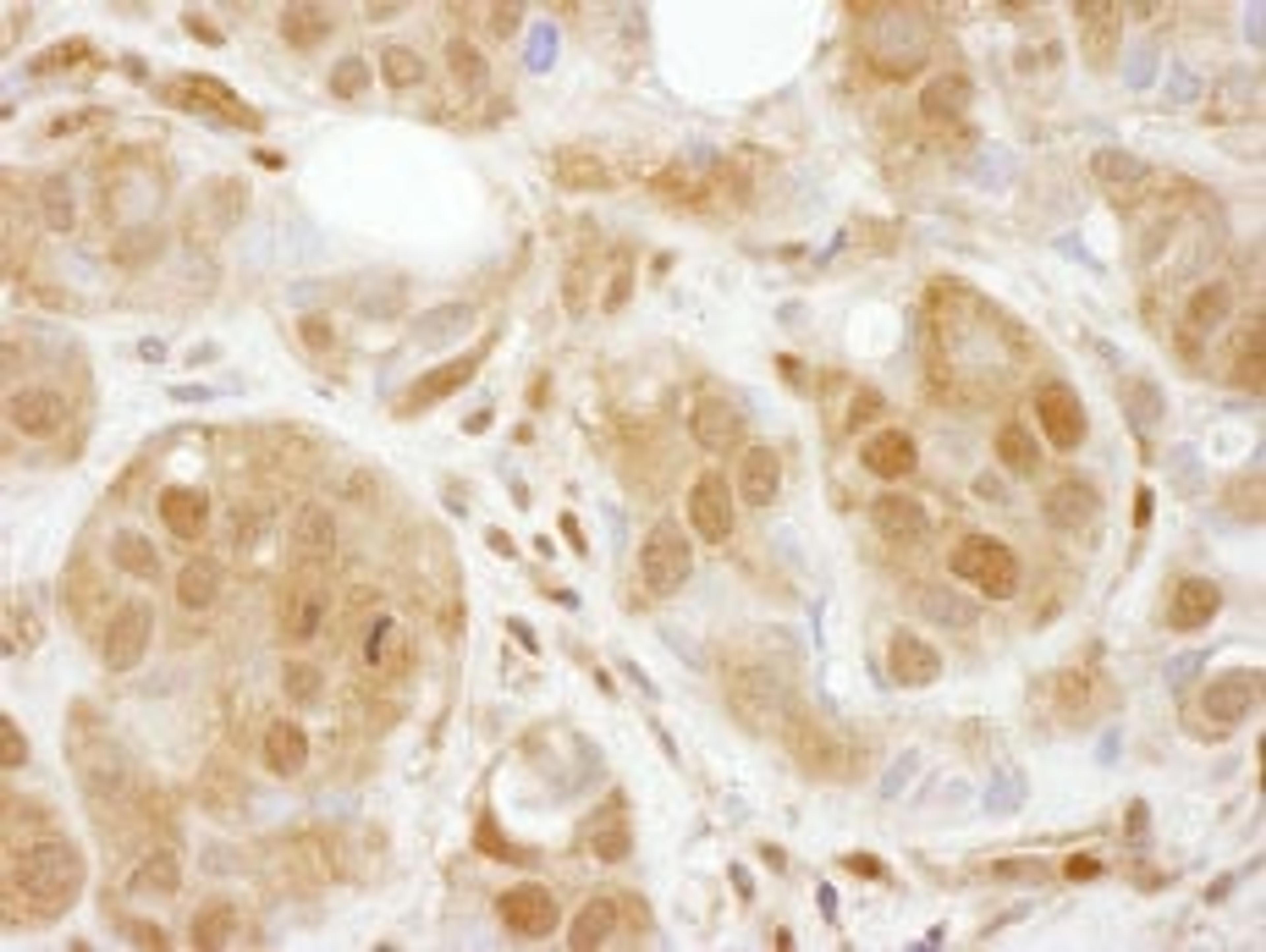 Detection of human TBP1 by immunohistochemistry.