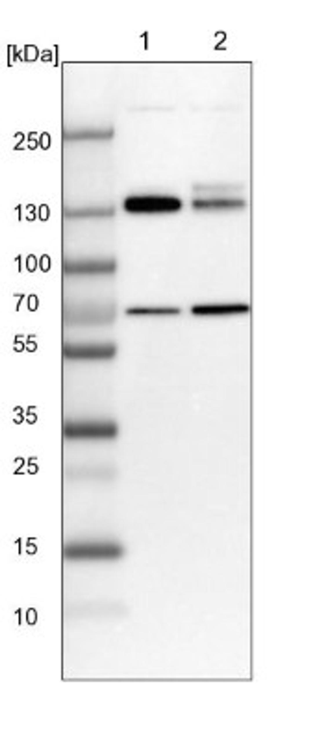 Western Blot: MPRIP Antibody [NBP1-81035] - Lane 1: NIH-3T3 cell lysate (Mouse embryonic fibroblast cells)<br/>Lane 2: NBT-II cell lysate (Rat Wistar bladder tumour cells)