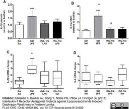 Rabbit anti Sheep interleukin 1β  used to detect bound interleukin 1β from lamb sera