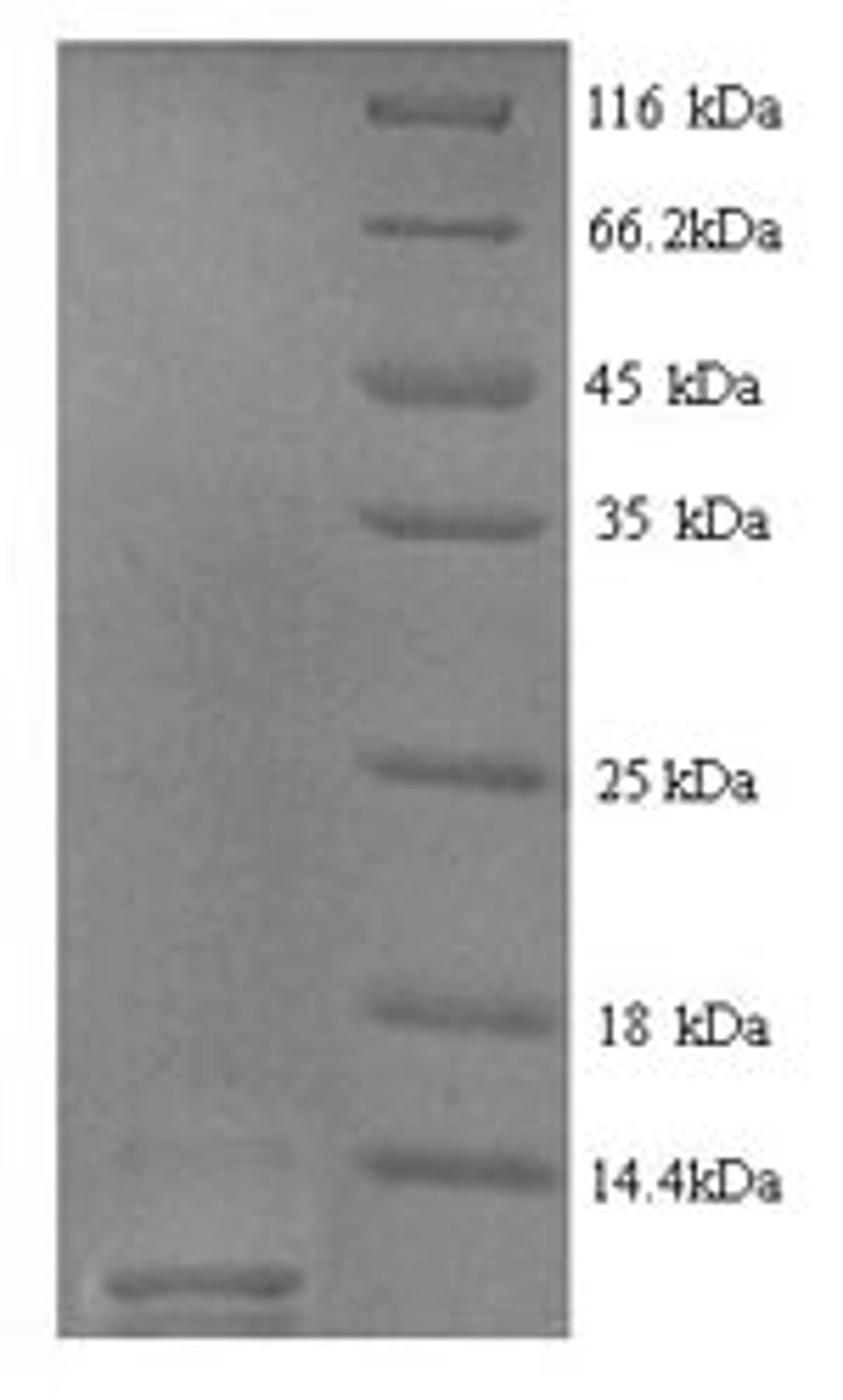 (Tris-Glycine gel) Discontinuous SDS-PAGE (reduced) with 5% enrichment gel and 15% separation gel.