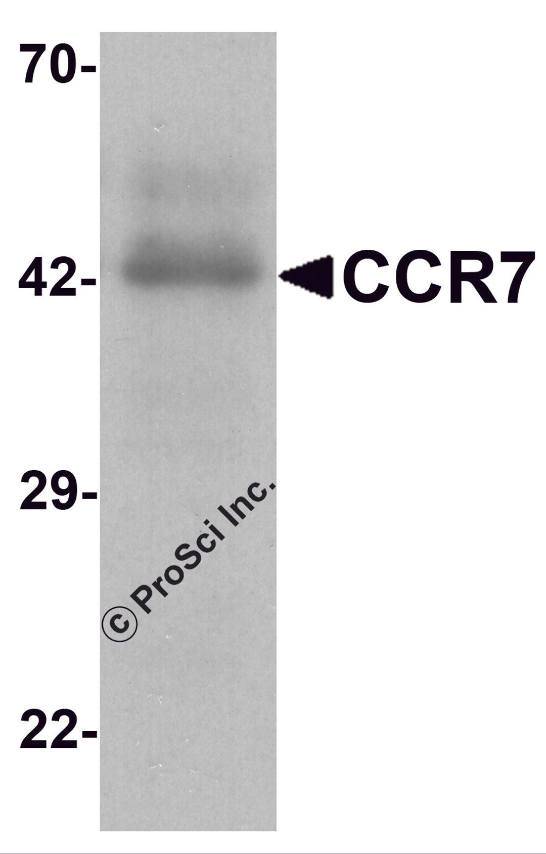Western blot analysis of CCR7 in human spleen tissue lysate with CCR7 antibody at 1 μg/ml.