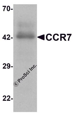 Western blot analysis of CCR7 in human spleen tissue lysate with CCR7 antibody at 1 μg/ml.