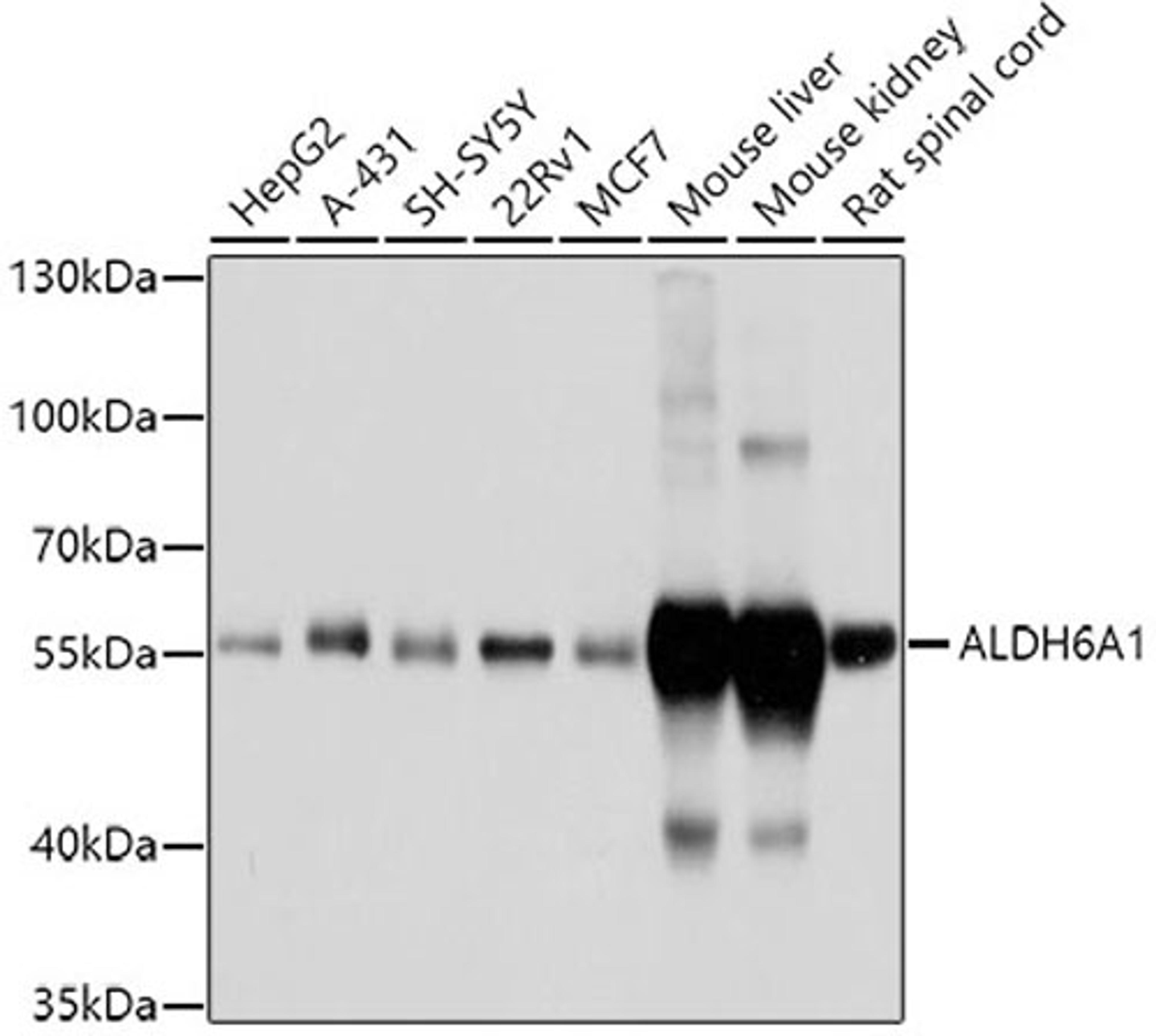 Western blot - ALDH6A1 antibody (A3309)