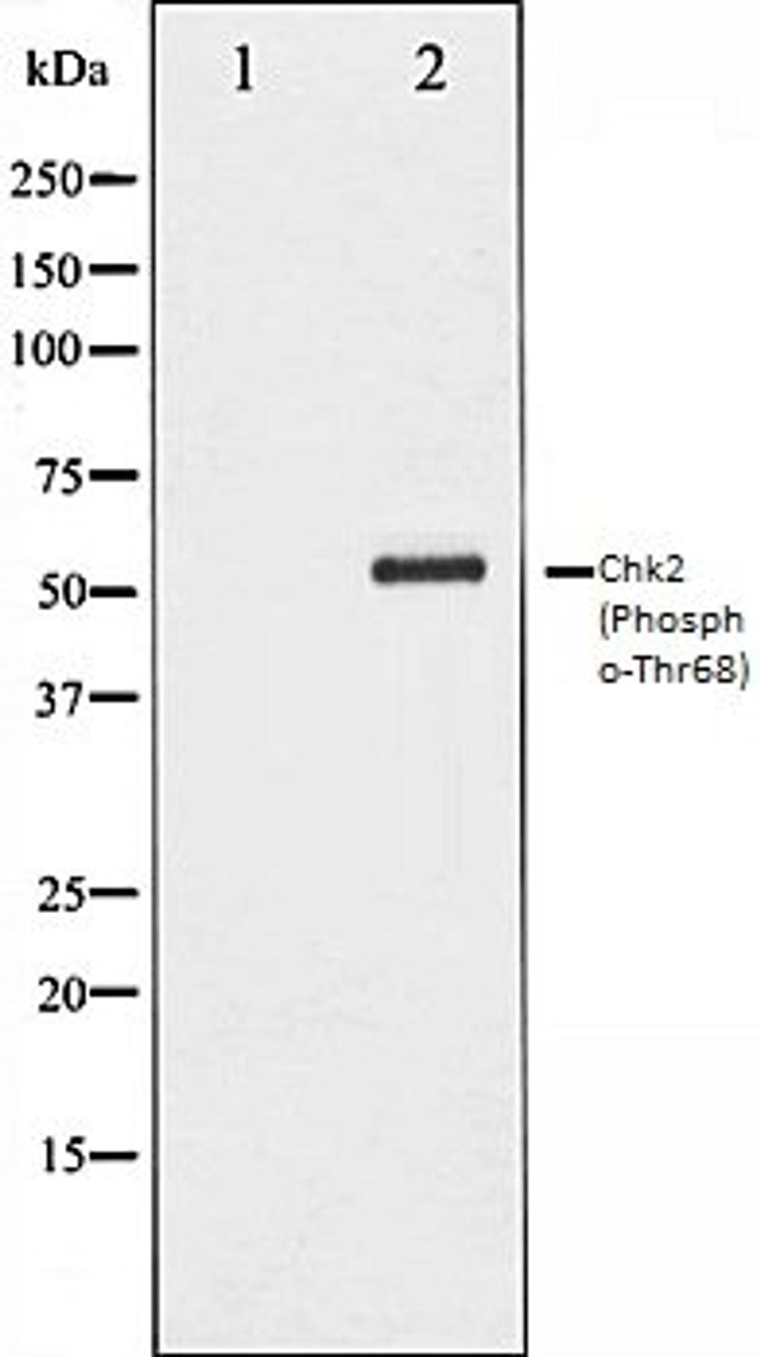 Western blot analysis of Jurkat whole cell lysates using Chk2 (Phospho-Thr68) antibody, The lane on the left is treated with the antigen-specific peptide.