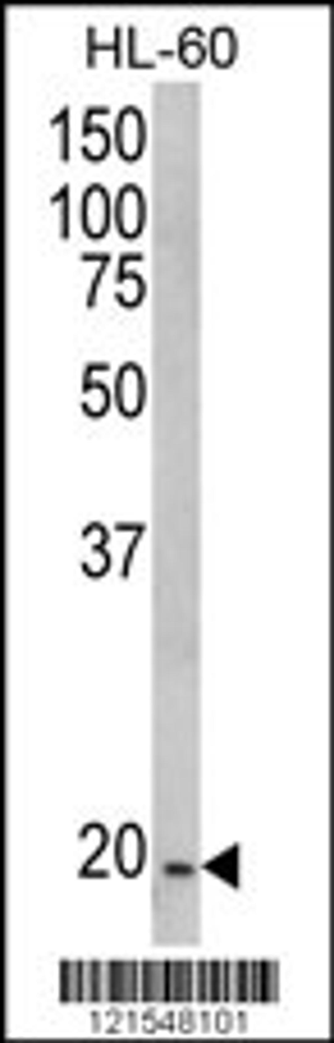 Western blot analysis of NDUFS4 Antibody in HL-60 cell line lysates (35ug/lane)