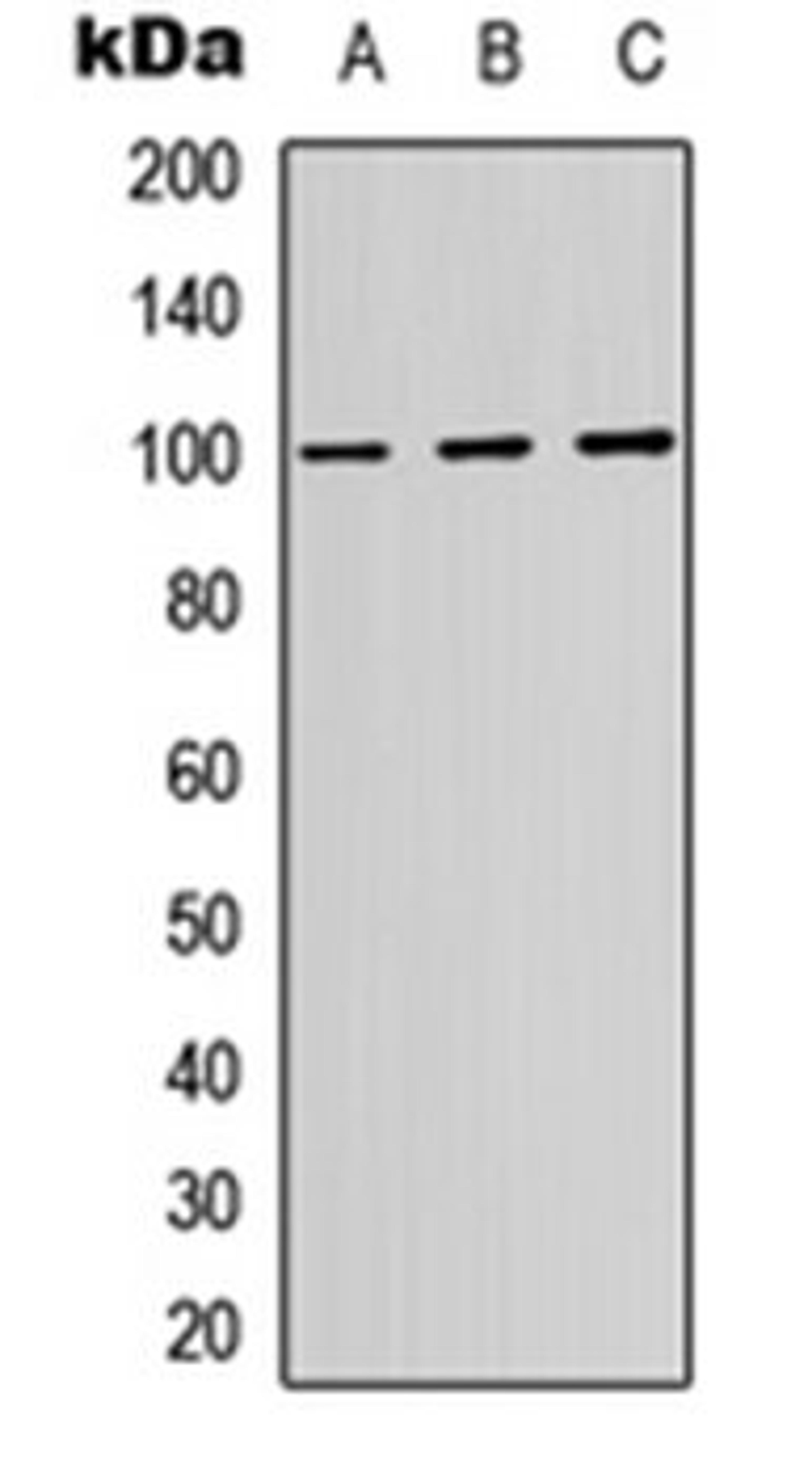 Western blot analysis of HeLa (Lane 1), A549 (Lane 2), HepG2 (Lane 3) whole cell lysates using ATP1A1 antibody