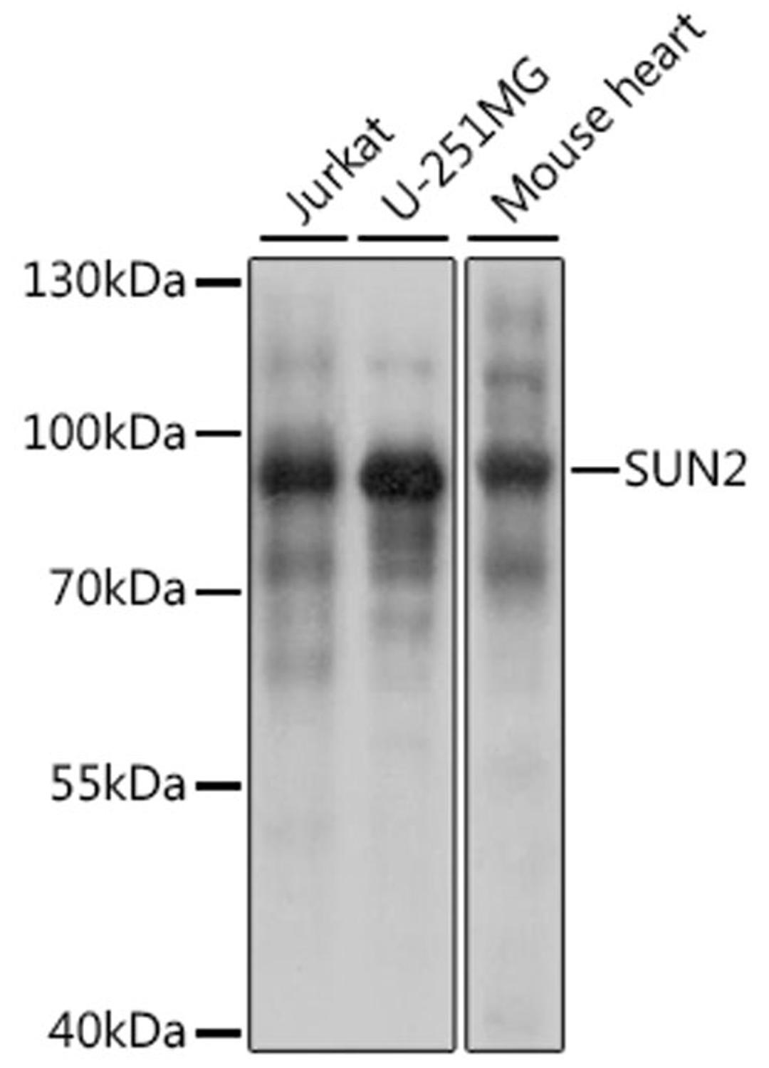 Western blot - SUN2 antibody (A16325)