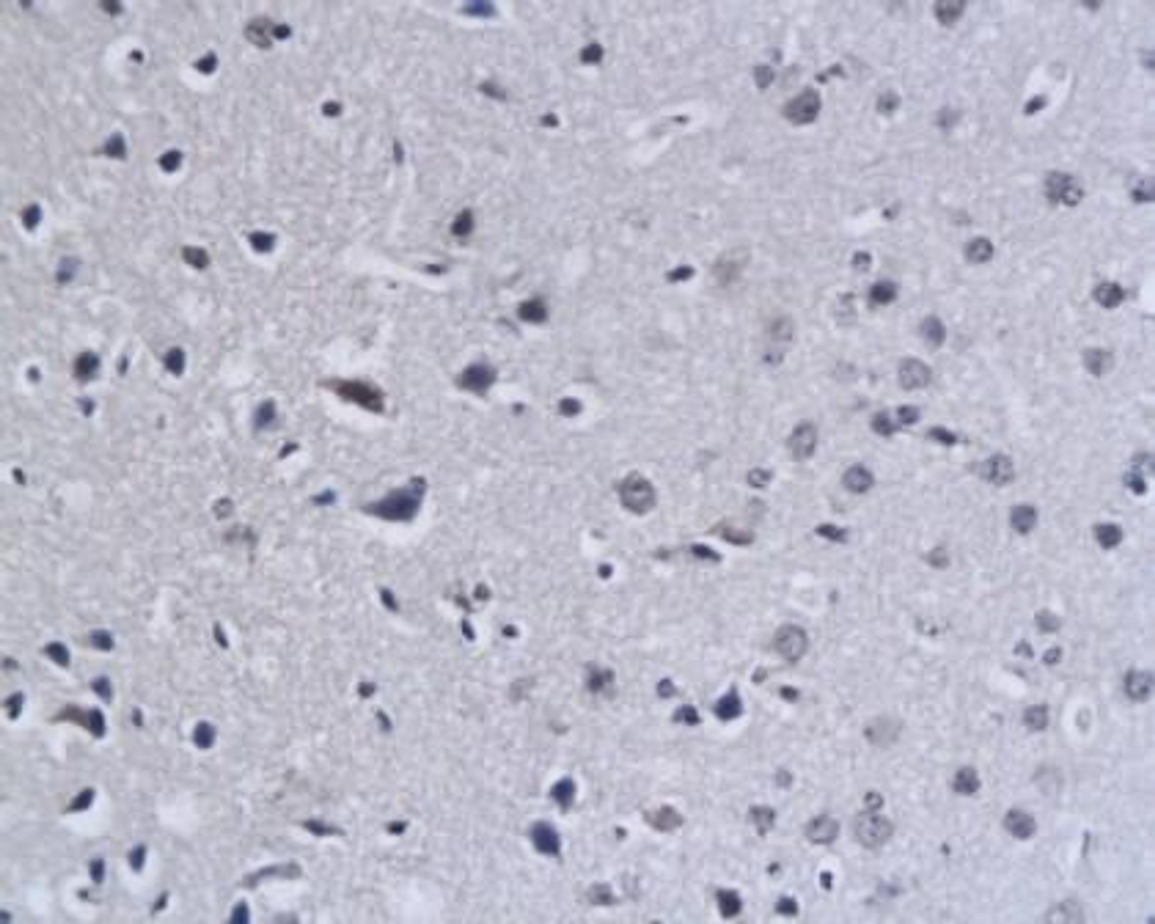 Immunohistochemical analysis of paraffin-embedded mouse brain tissue using 5HT2A Receptor antibody