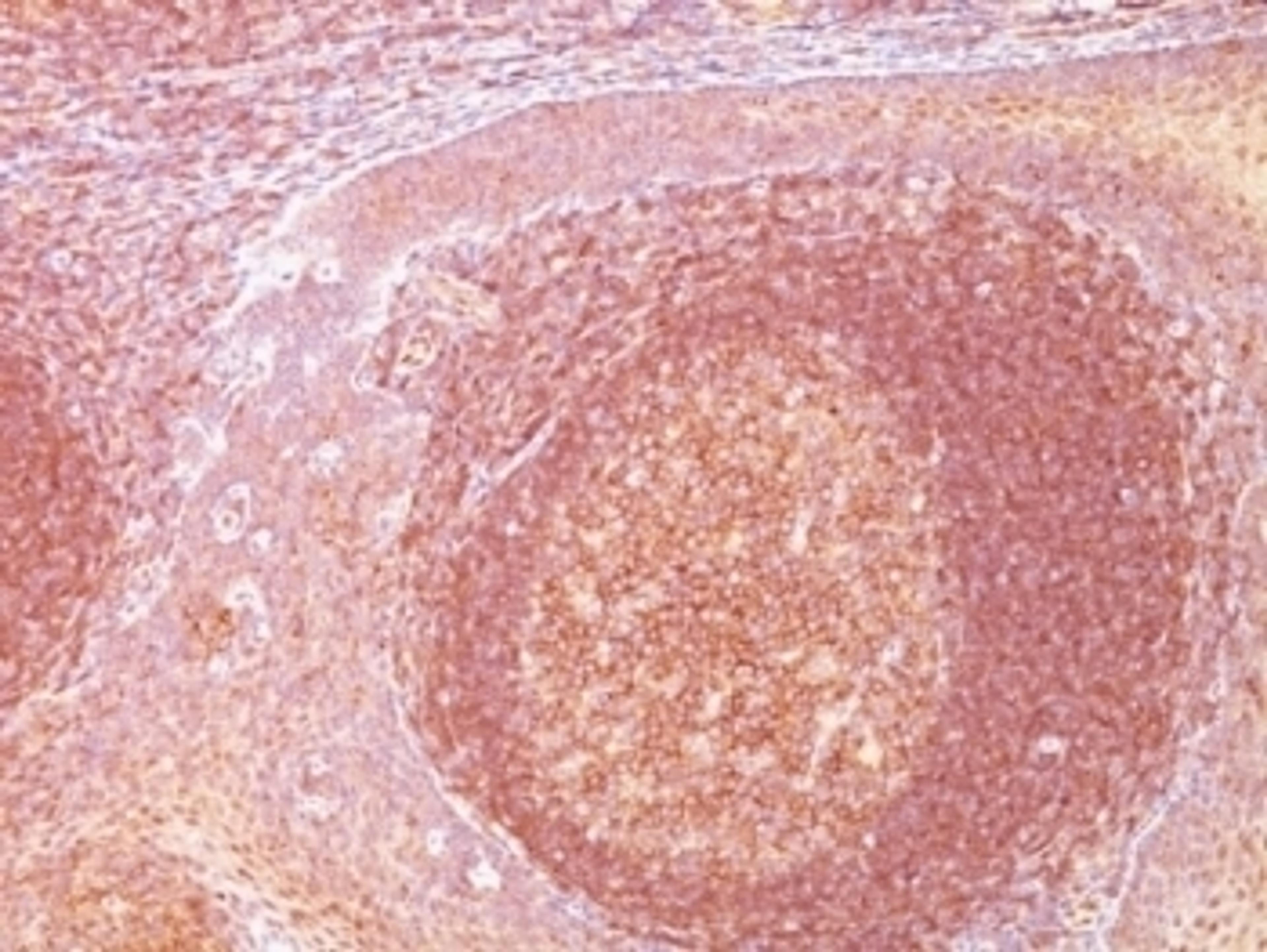 Formalin-fixed, paraffin-embedded human tonsil stained with Bcl10 antibody (SPM520).