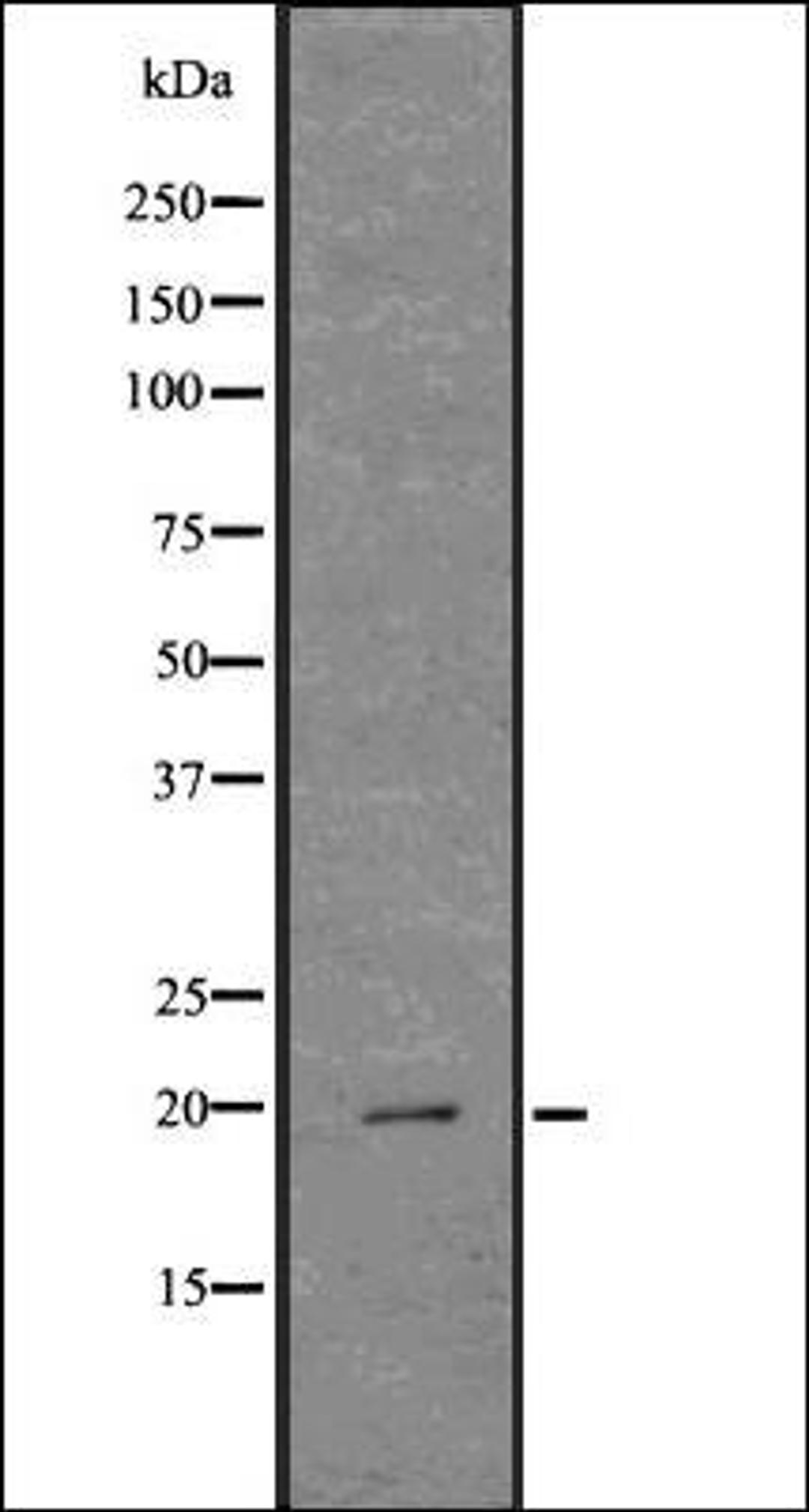 Western blot analysis of COLO205 whole cell lysates using Cathelicidin antibody