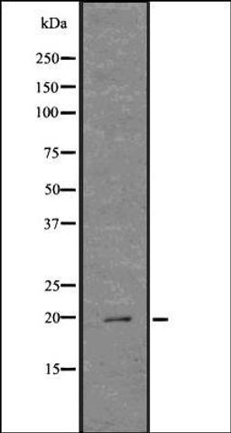 Western blot analysis of COLO205 whole cell lysates using Cathelicidin antibody