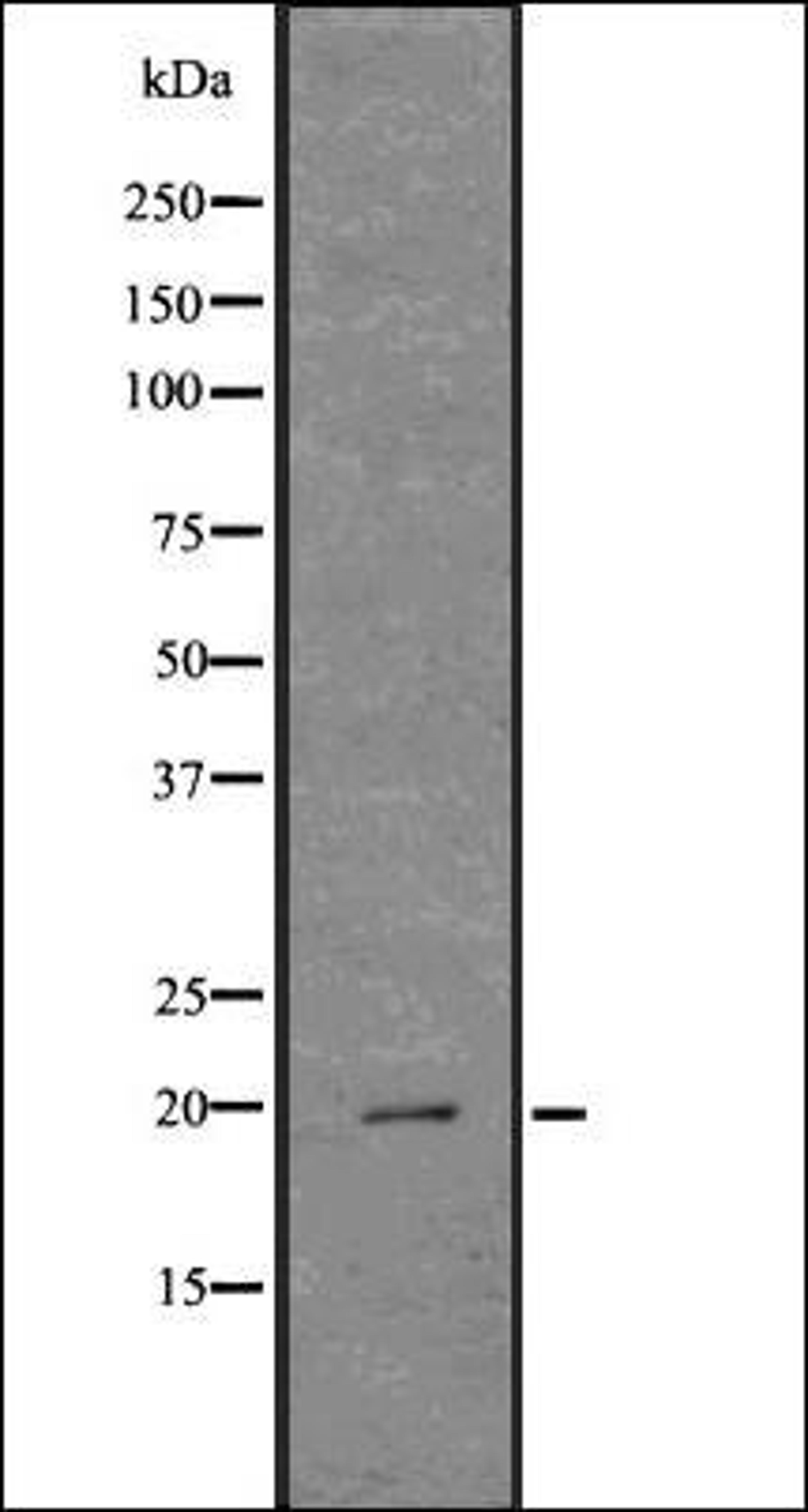 Western blot analysis of COLO205 whole cell lysates using Cathelicidin antibody