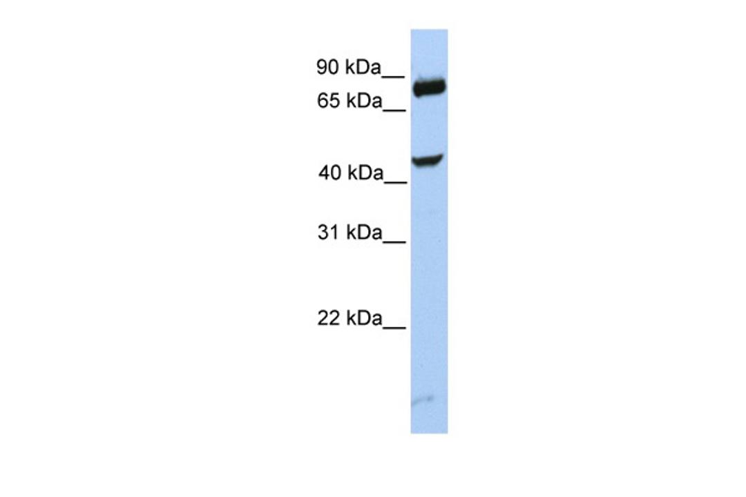 Antibody used in WB on Human MCF-7 at 0.2-1 ug/ml.