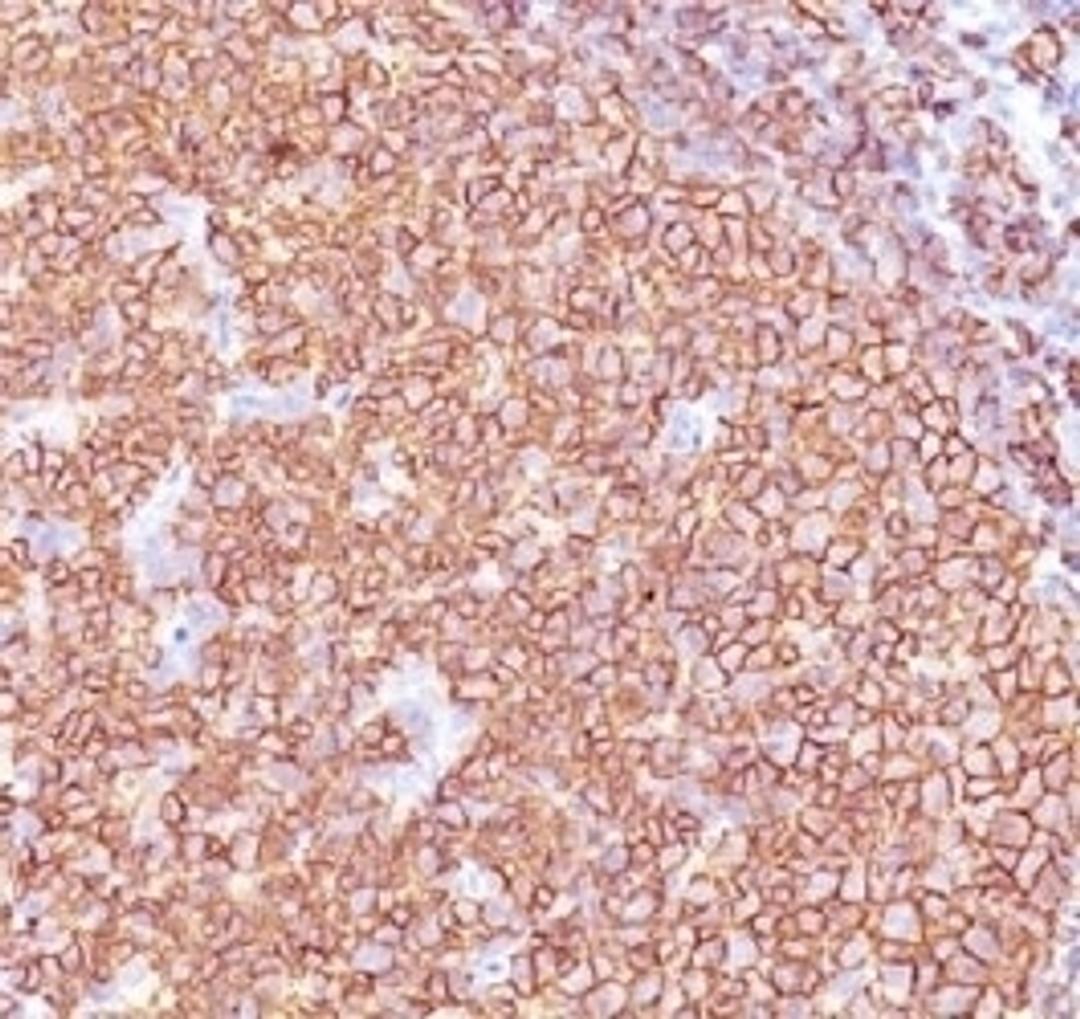 IHC testing of anti-CD20 antibody and FFPE human tonsil tissue