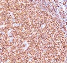 IHC testing of anti-CD20 antibody and FFPE human tonsil tissue