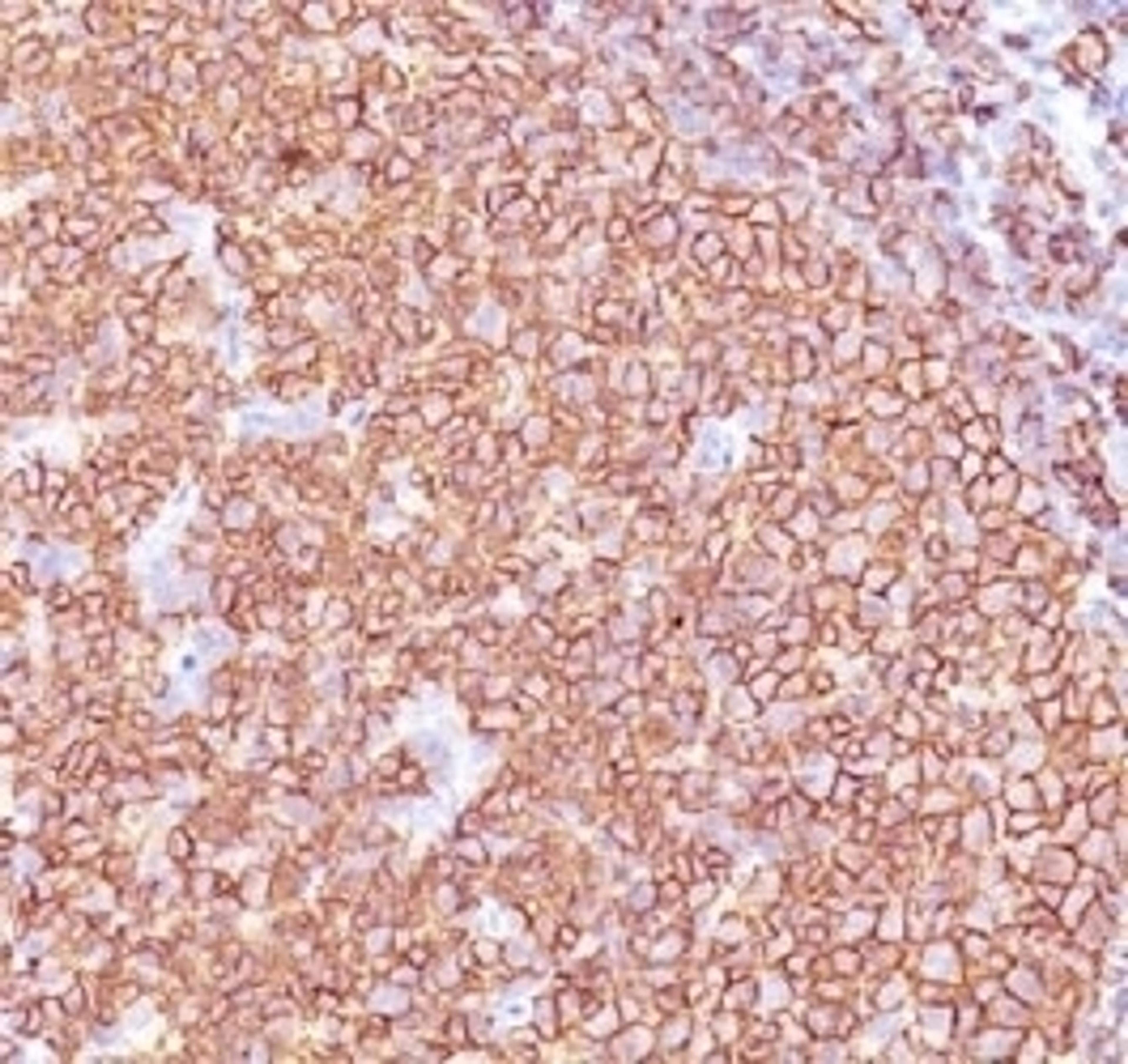 IHC testing of anti-CD20 antibody and FFPE human tonsil tissue