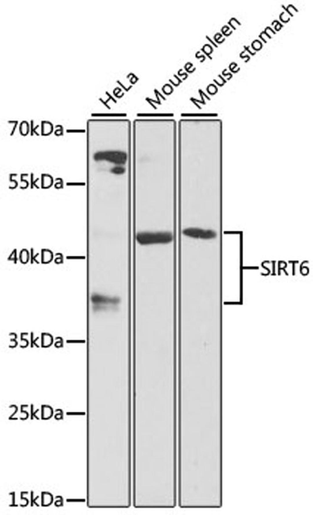 Western blot - SIRT6 antibody (A7416)