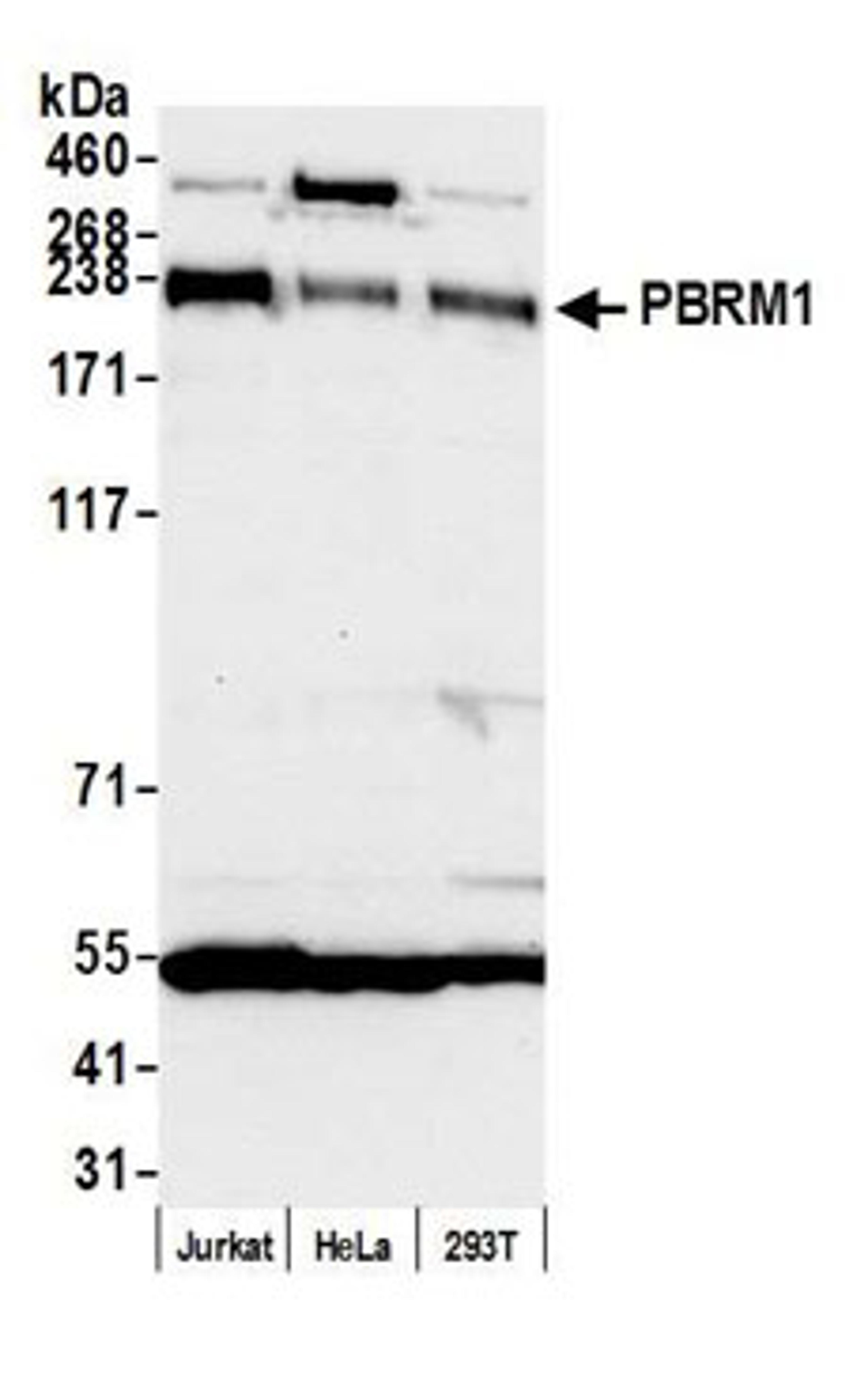 Detection of human PBRM1 by western blot.