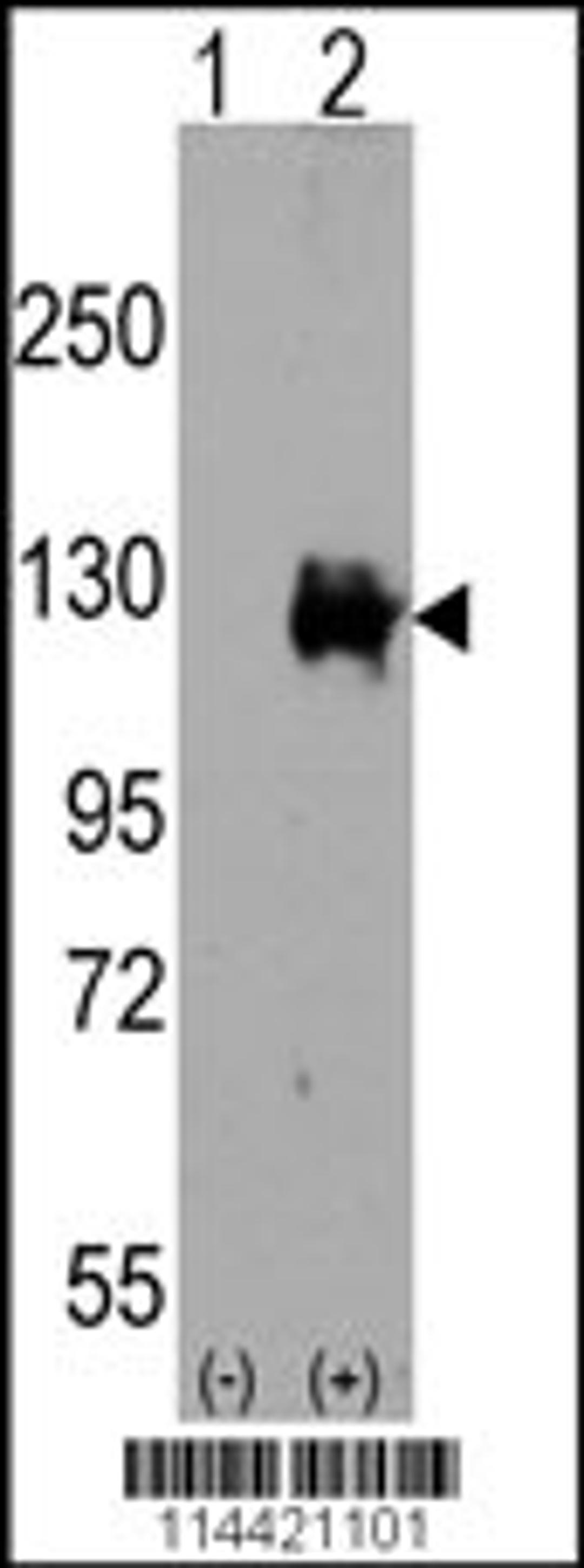 Western blot analysis of TRPM8 using rabbit polyclonal TRPM8 Antibody.293 cell lysates (2 ug/lane) either nontransfected (Lane 1) or transiently transfected with the TRPM8 gene (Lane 2).