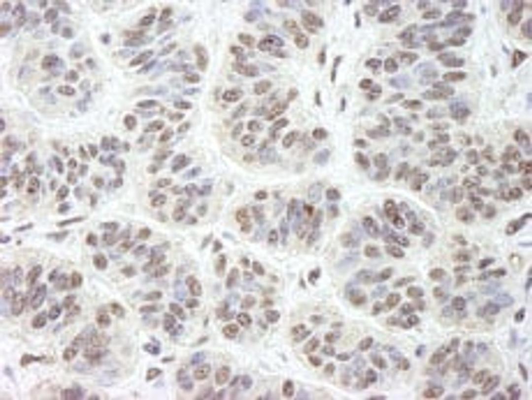 Detection of human GNL3 by immunohistochemistry.