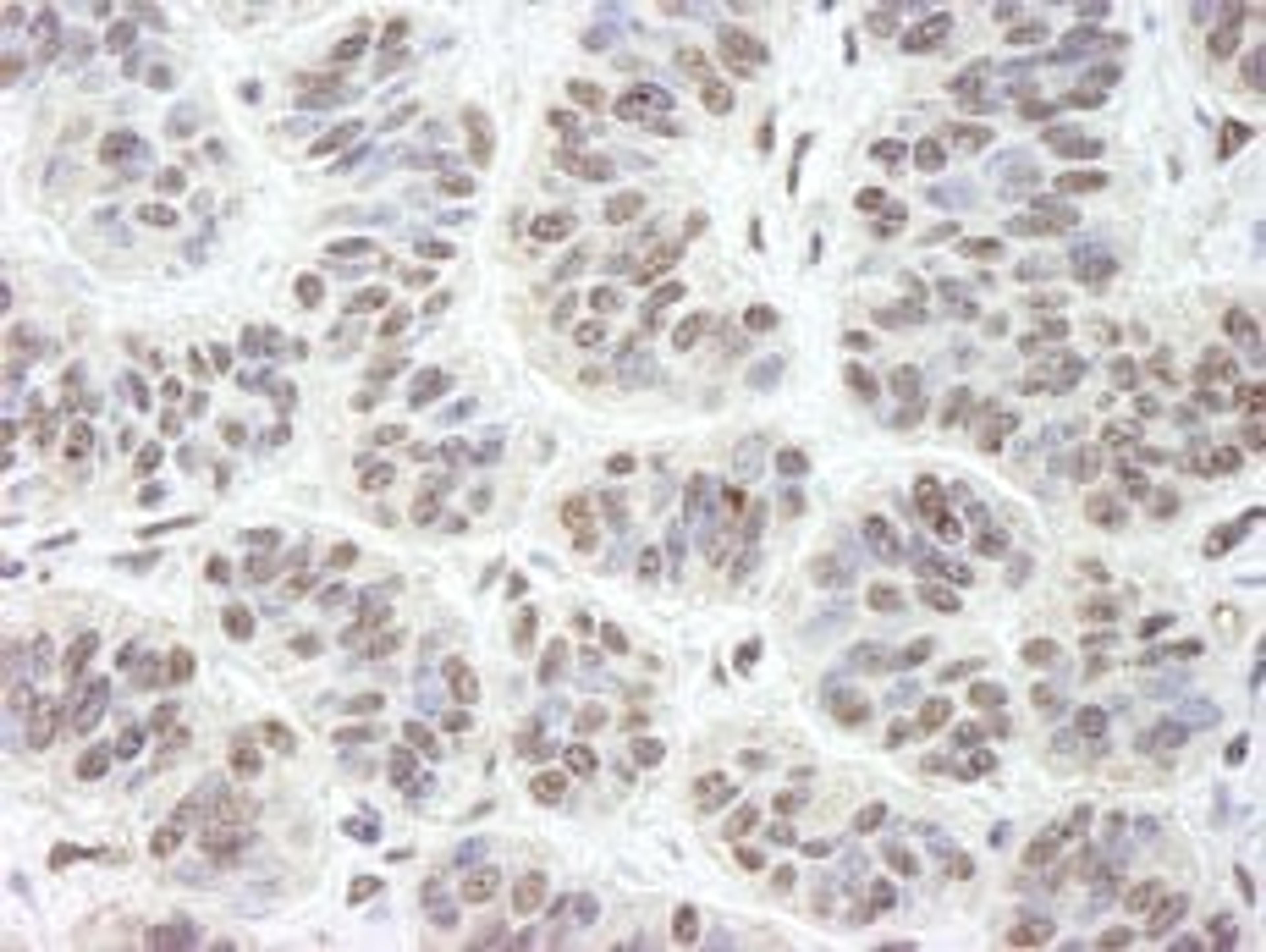 Detection of human GNL3 by immunohistochemistry.