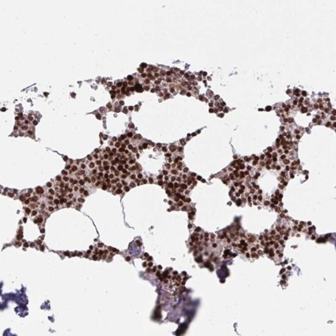 Immunohistochemistry: NIP7 Antibody [NBP2-31801] - Staining of human bone marrow shows strong nuclear positivity in hematopoietic cells.