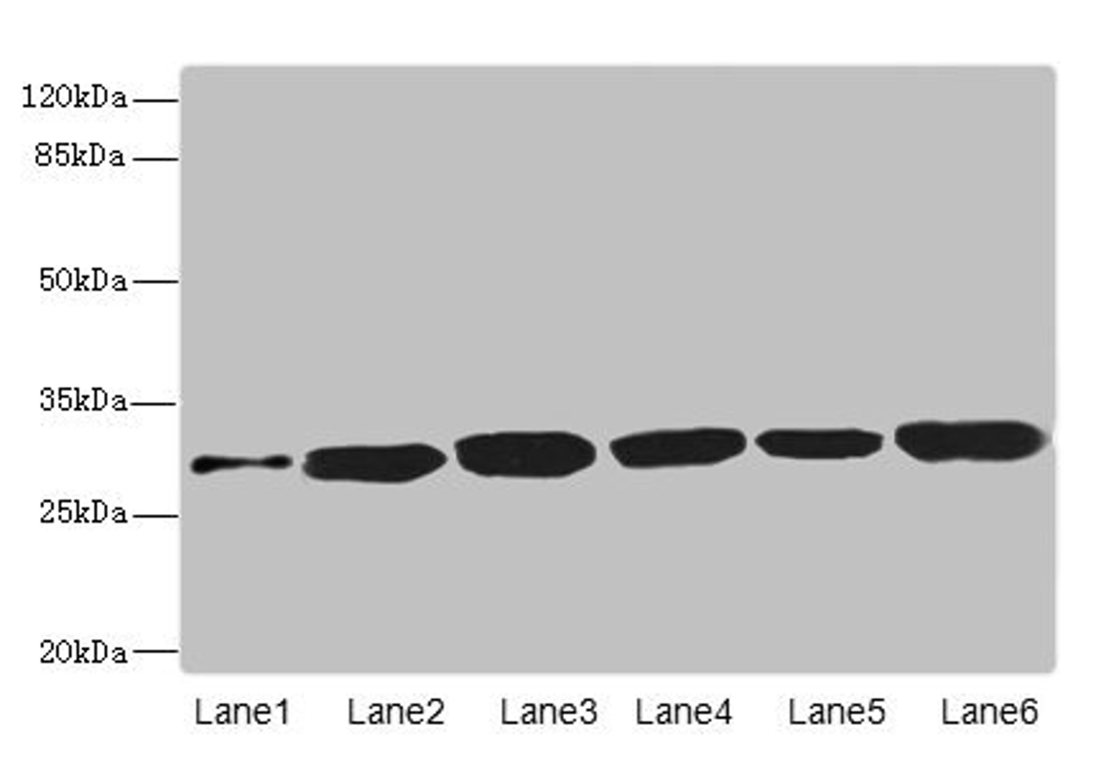 Western blot. All lanes: BPGM antibody at 5.94µg/ml. Lane 1: Human peripheral blood mononuclear cells. Lane 2: Mouse liver tissue. Lane 3: Human placenta tissue. Lane 4: Hela whole cell lysate. Lane 5: 293T whole cell lysate. Lane 6: A549 whole cell lysate. Secondary. Goat polyclonal to rabbit IgG at 1/10000 dilution. Predicted band size: 30 kDa. Observed band size: 30 kDa
