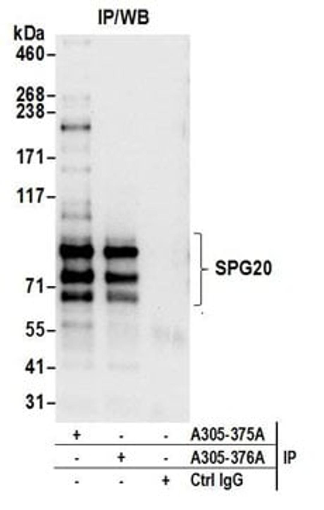 Detection of human SPG20 by western blot of immunoprecipitates.