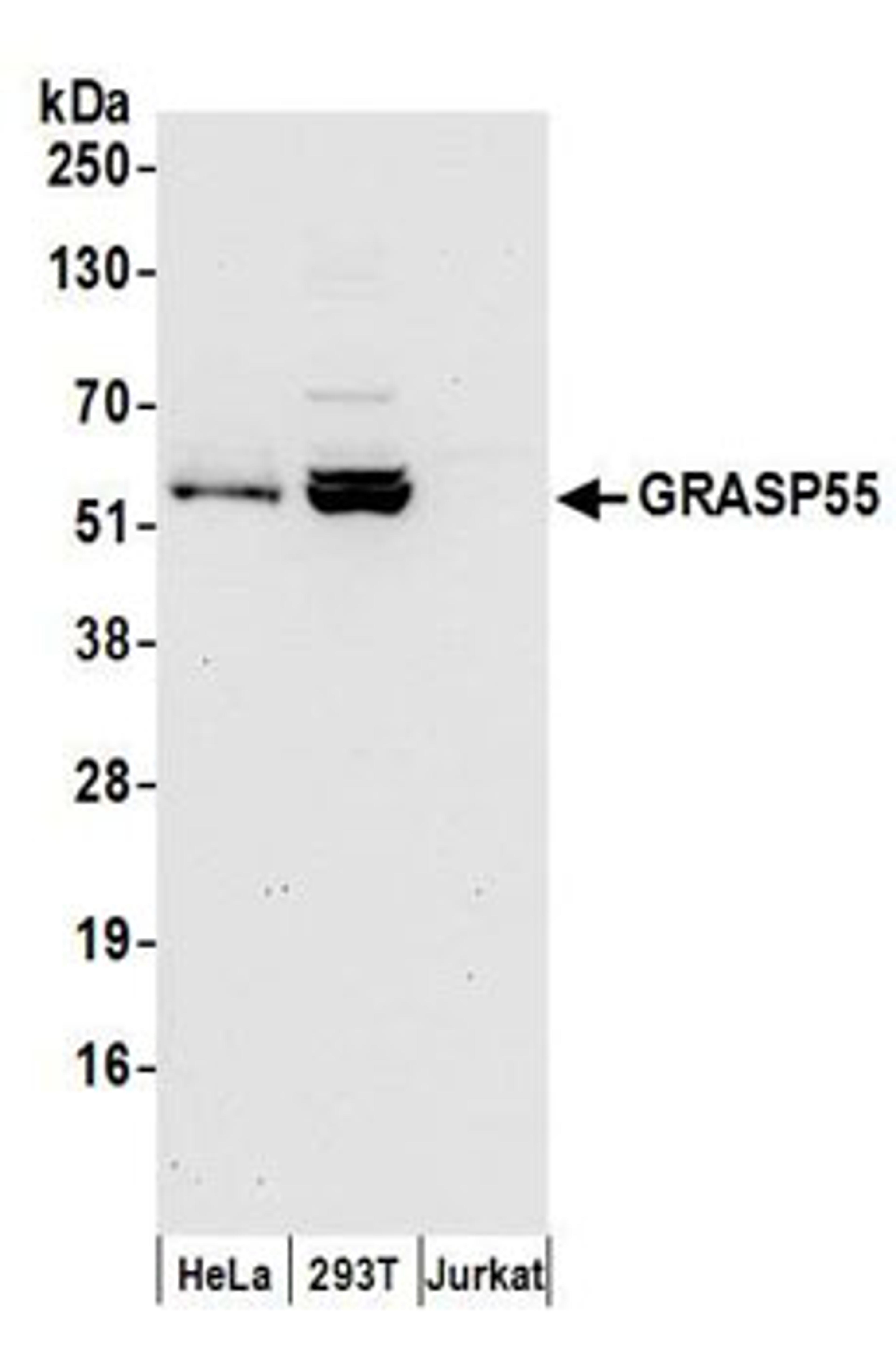 Detection of human GRASP55 by western blot.