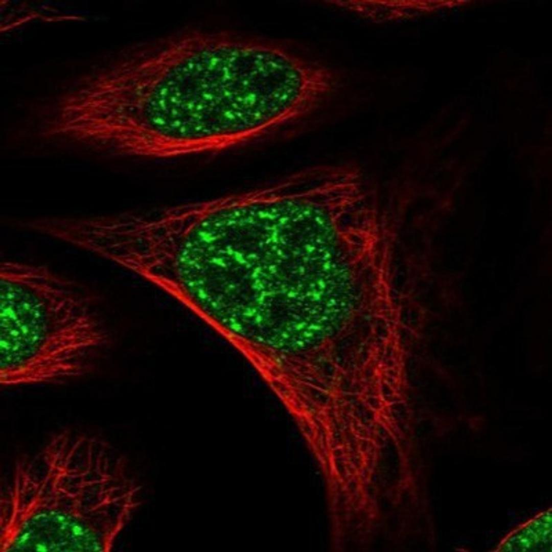 Immunocytochemistry/Immunofluorescence: FBXL4 Antibody [NBP1-84727] - Staining of human cell line U-2 OS shows positivity in nucleus but not nucleoli.