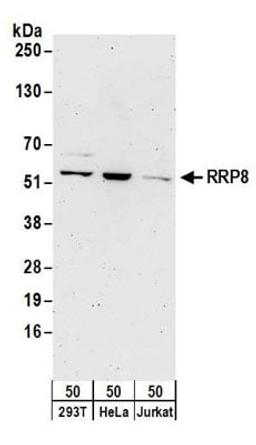 Detection of human RRP8 by western blot.