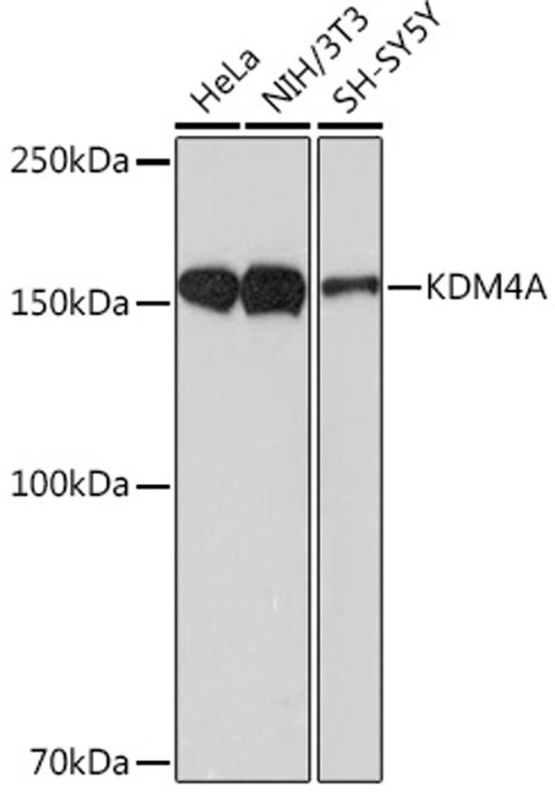 Western blot - KDM4A Rabbit mAb (A9267)