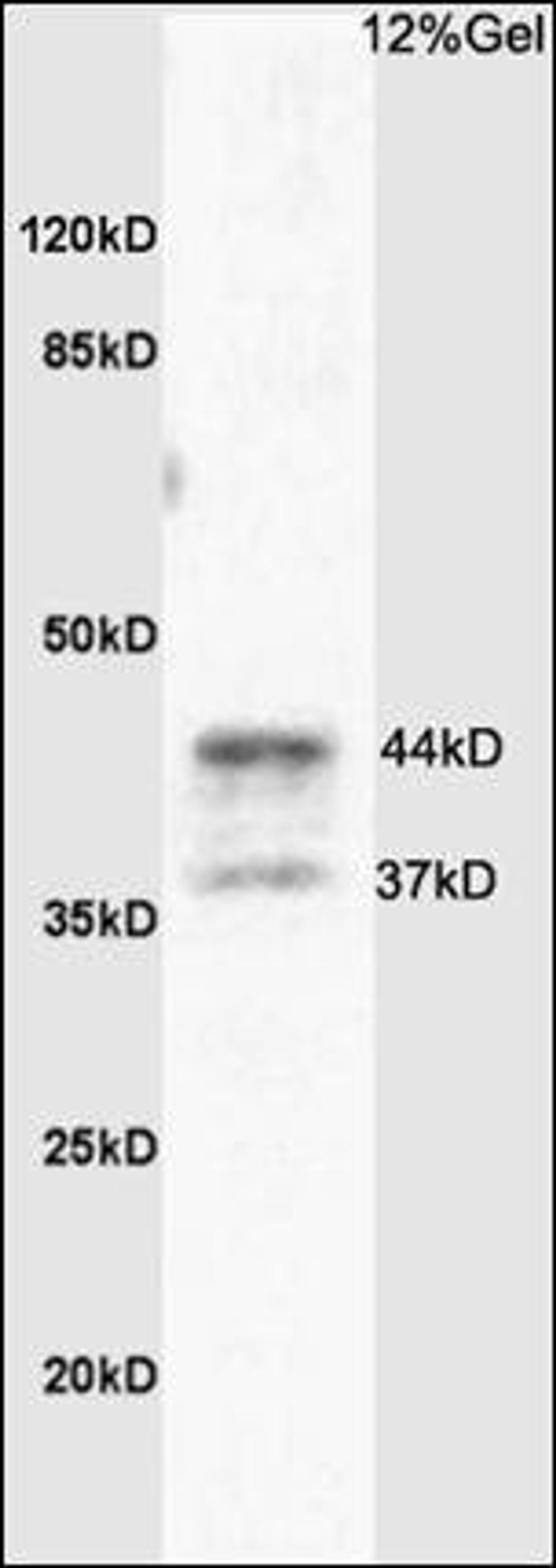 Western blot analysis of rat brain tissue using PAR4 antibody.