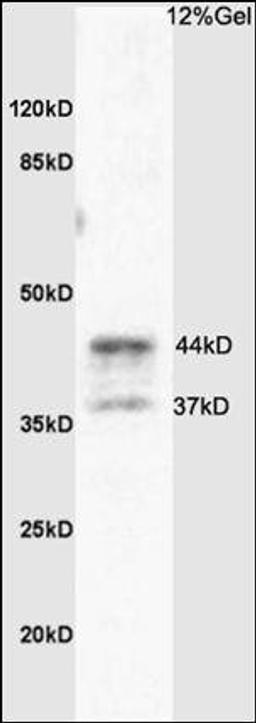 Western blot analysis of rat brain tissue using PAR4 antibody.