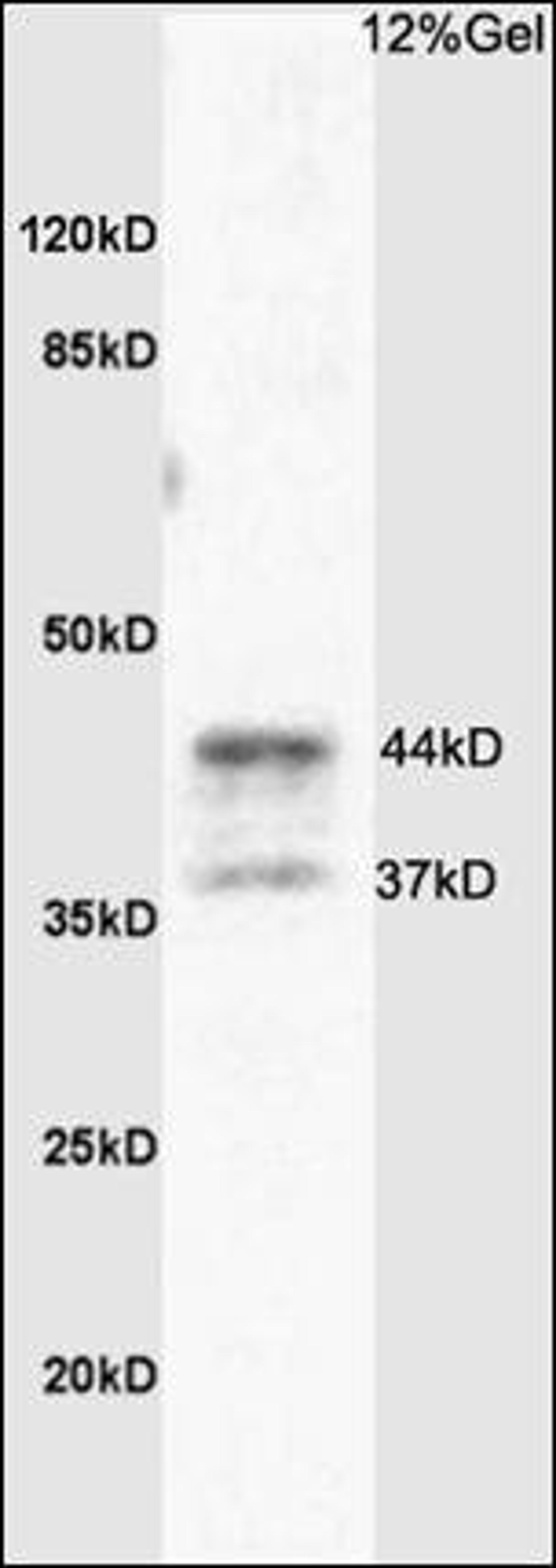 Western blot analysis of rat brain tissue using PAR4 antibody.