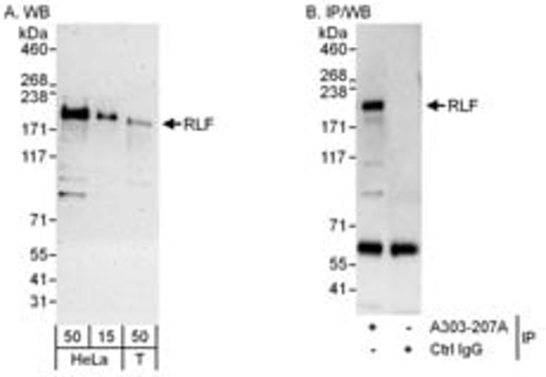 Detection of human RLF by western blot and immunoprecipitation.