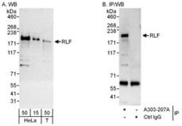 Detection of human RLF by western blot and immunoprecipitation.