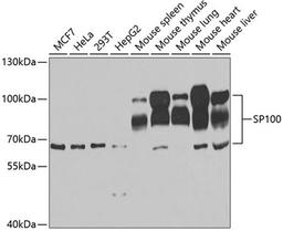 Western blot - SP100 antibody (A5851)