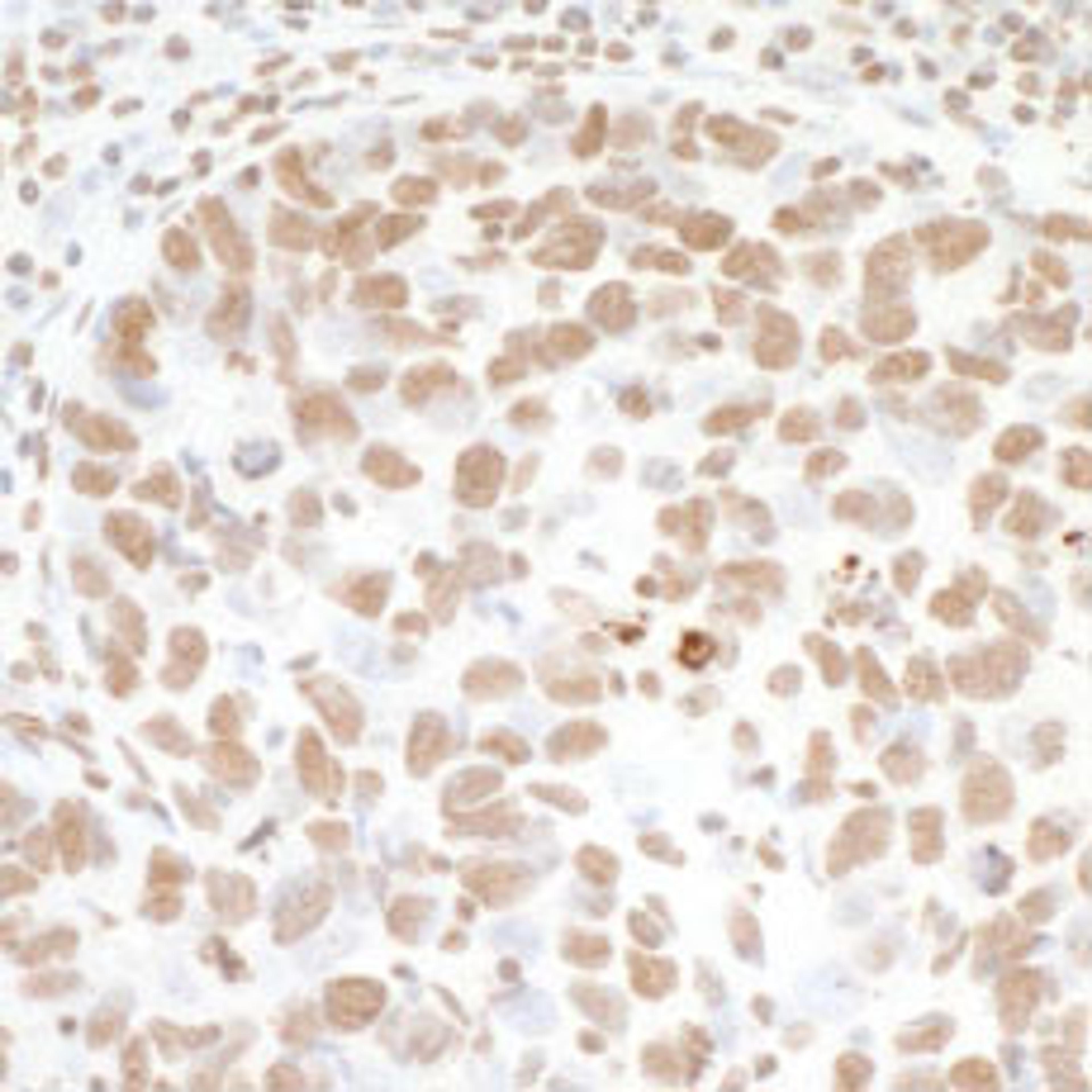 Detection of human Histone H3 by immunohistochemistry.