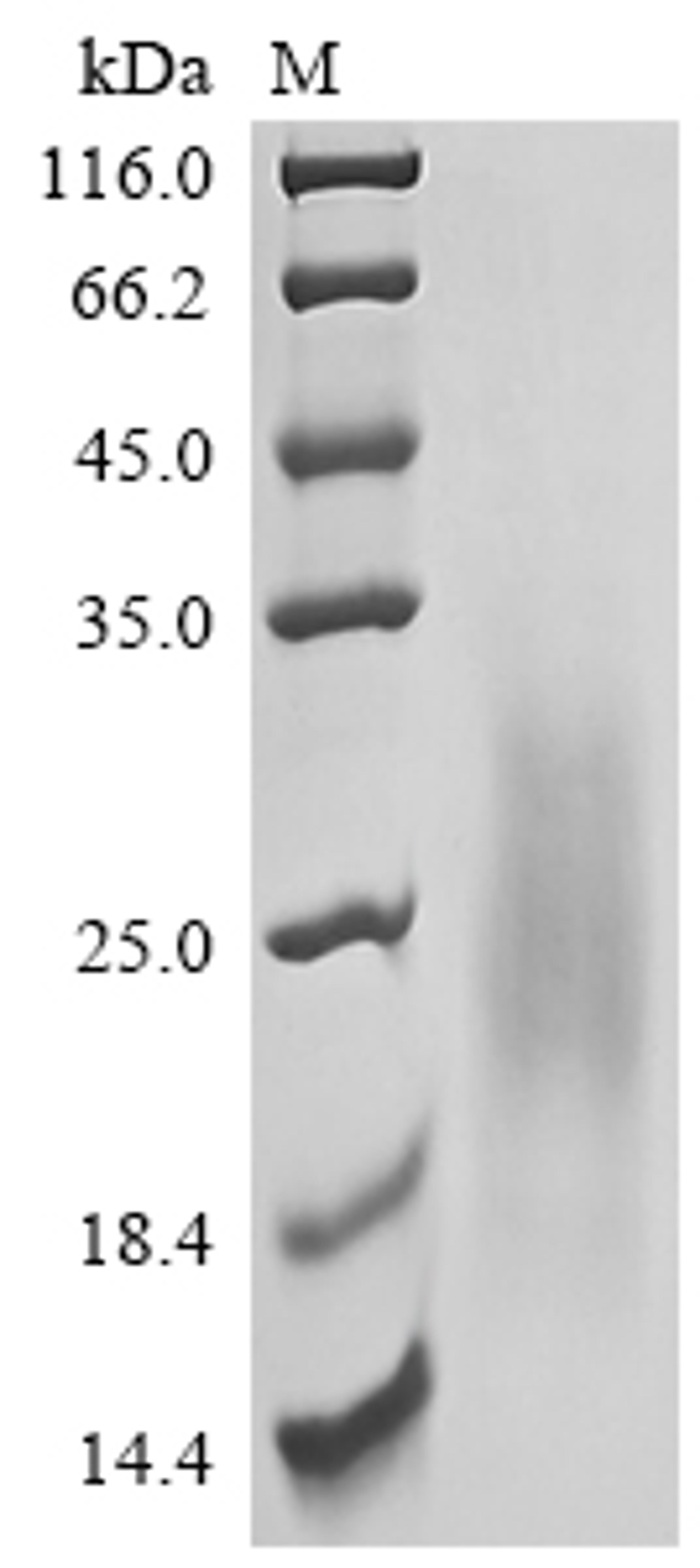 (Tris-Glycine gel) Discontinuous SDS-PAGE (reduced) with 5% enrichment gel and 15% separation gel.
