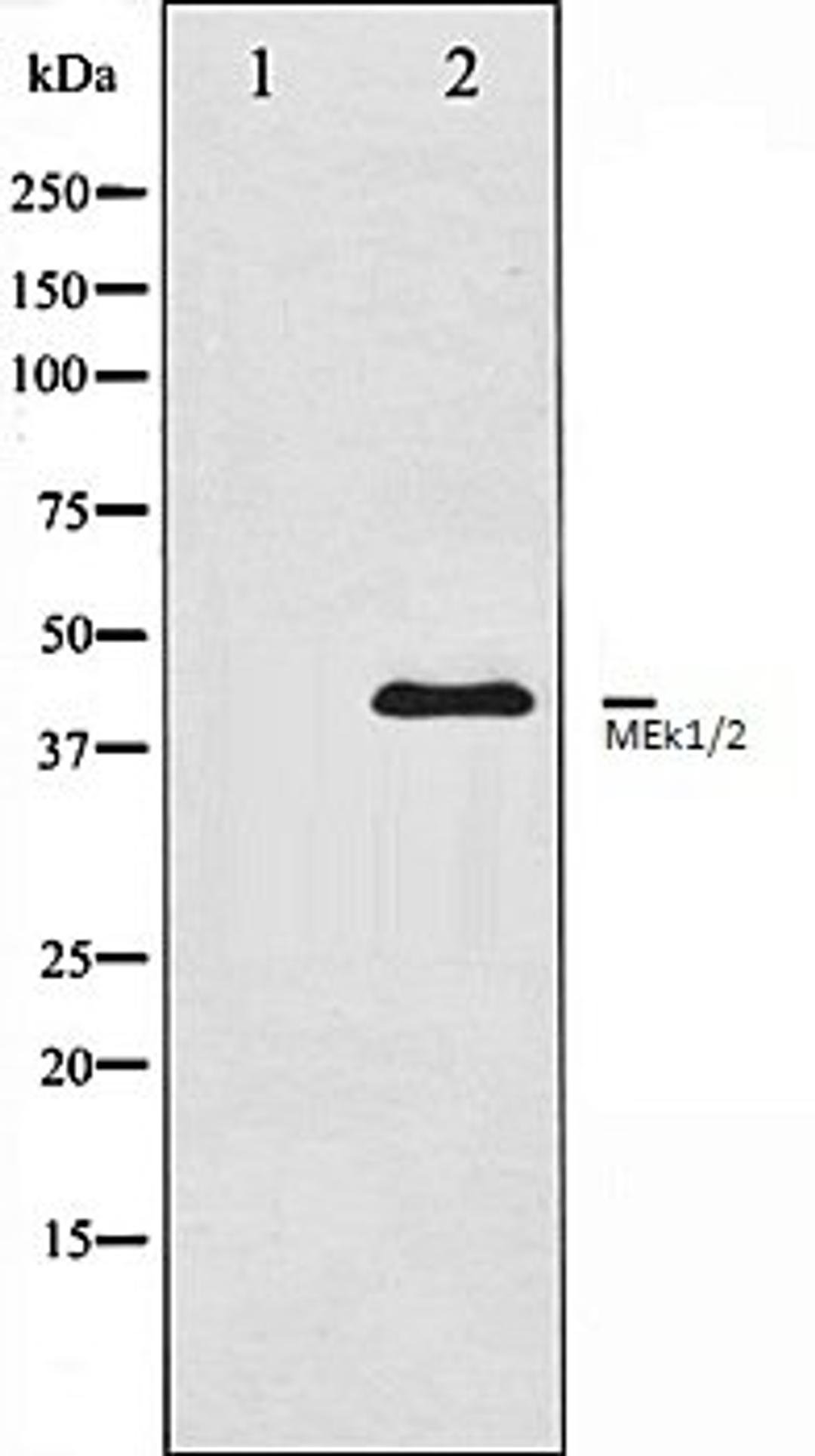 Western blot analysis of HeLa whole cell lysates using MEK1/2 antibody, The lane on the left is treated with the antigen-specific peptide.