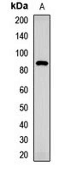 Western blot analysis of mouse eye (Lane1) whole cell lysates using TMC1 antibody