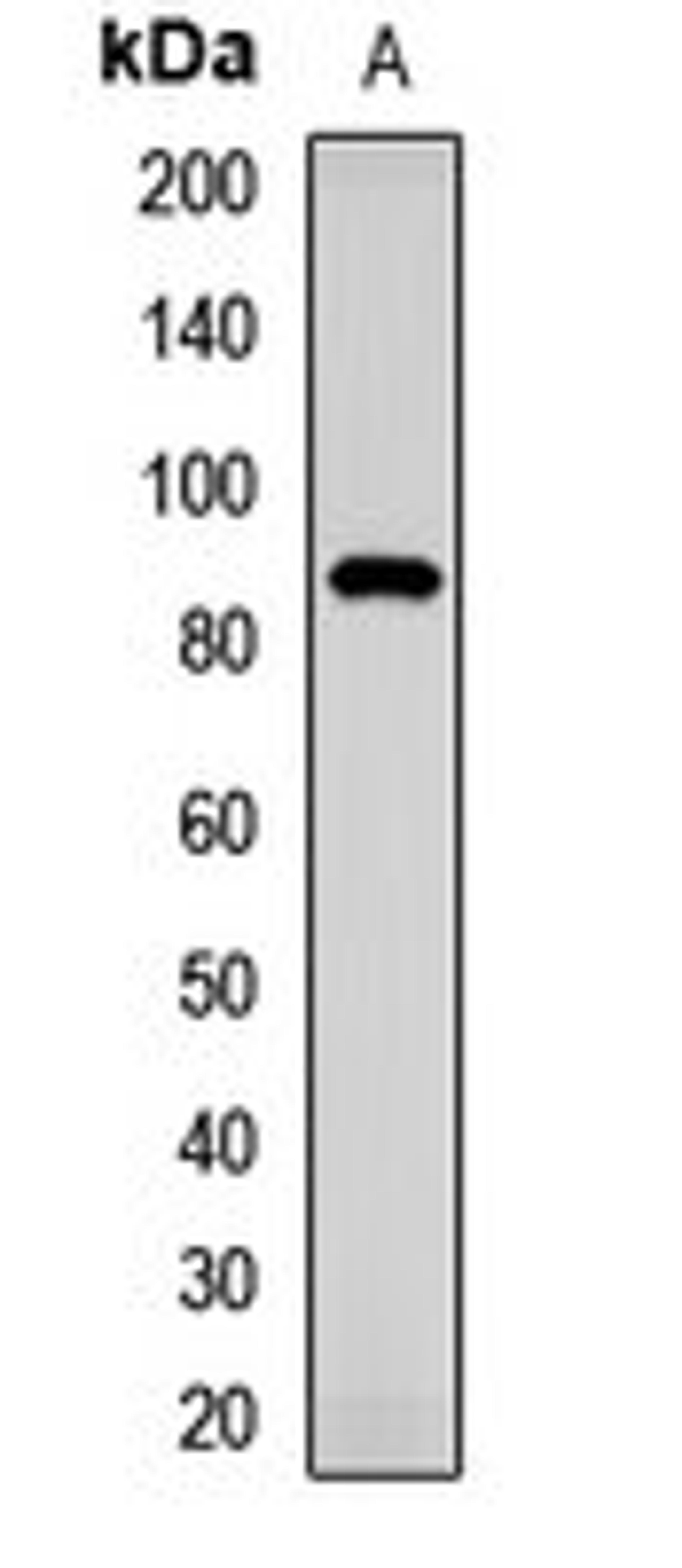 Western blot analysis of mouse eye (Lane1) whole cell lysates using TMC1 antibody