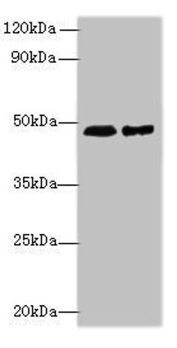 Western blot. All lanes: AARSD1 antibody at 0.8µg/ml. Lane 1: Hela whole cell lysate. Lane 2: U251 whole cell lysate. Secondary. Goat polyclonal to rabbit IgG at 1/10000 dilution. Predicted band size: 46, 59, 66 kDa. Observed band size: 46 kDa