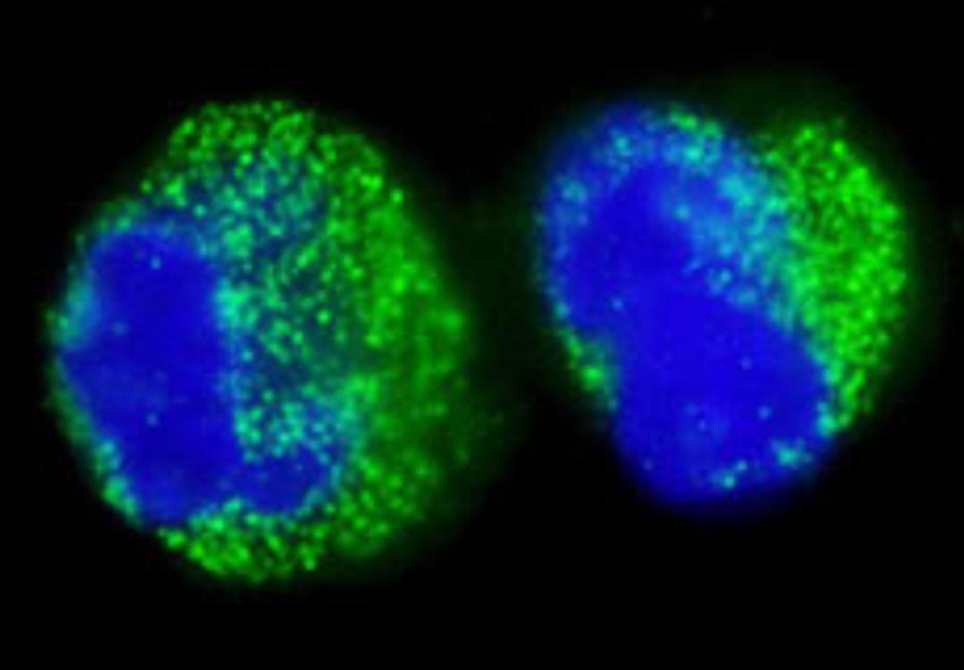 Detection of human BCR by immunocytochemistry.