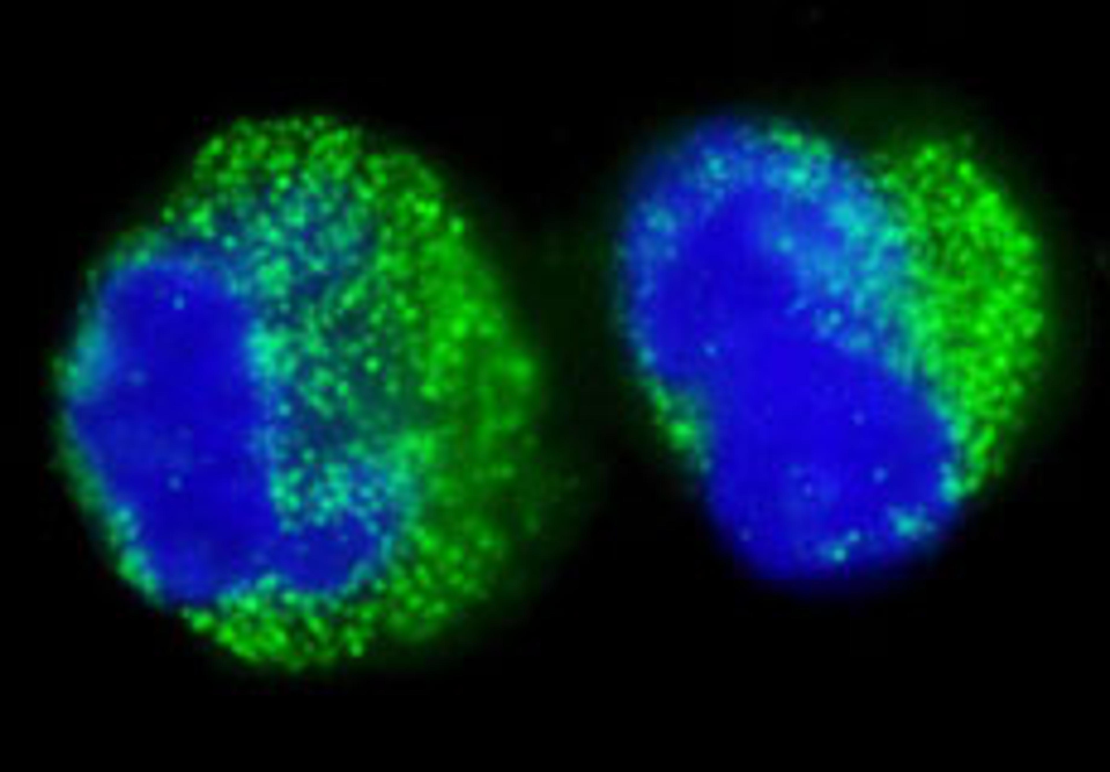 Detection of human BCR by immunocytochemistry.