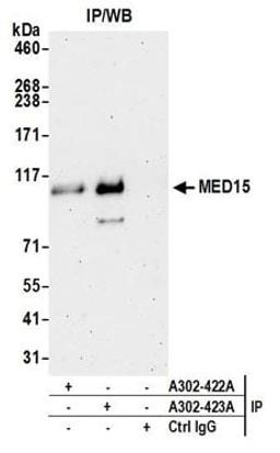 Detection of human MED15 by western blot of immunoprecipitates.